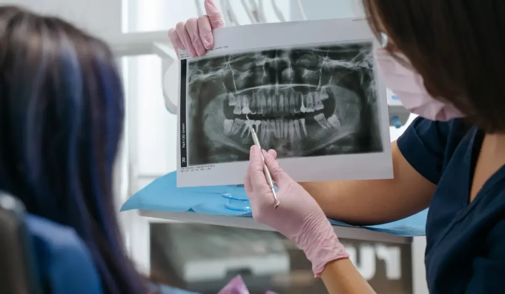 Dentist reviewing a patient’s cracked tooth X-ray to explain treatment options and ensure accurate dental restoration.