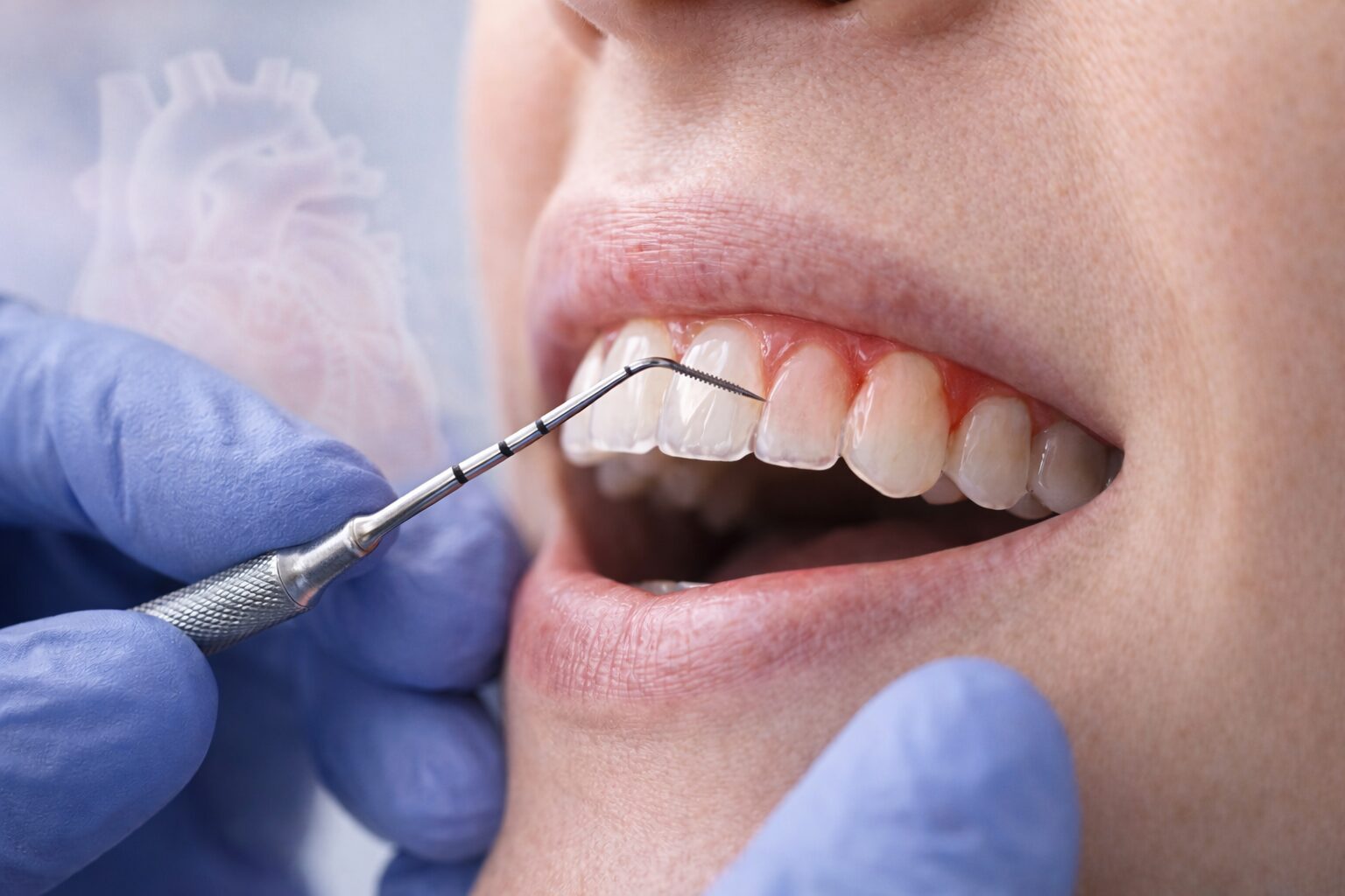 Clinical gum disease examination showing early inflammation linked to increased heart health risk.