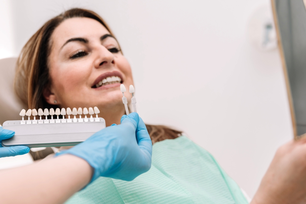 Close-up of a dentist in blue gloves holding a tooth shade guide and individual samples against a patient's smile to find a color match for veneers or whitening.