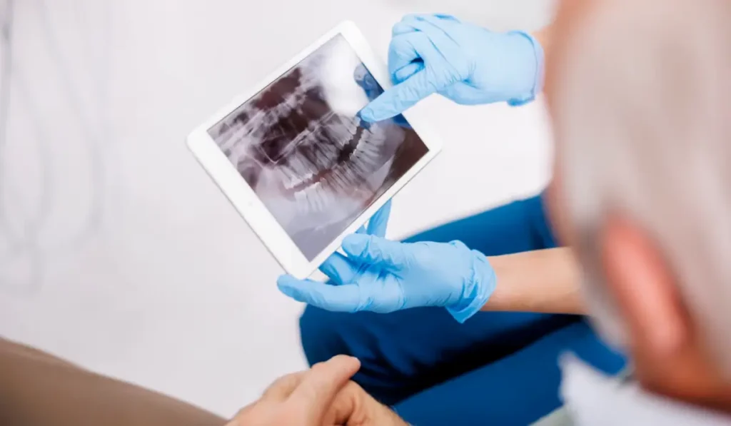 Dentist reviewing dental X-ray with patient during Same-Day Dentist Appointments to assess urgent tooth condition and determine immediate treatment